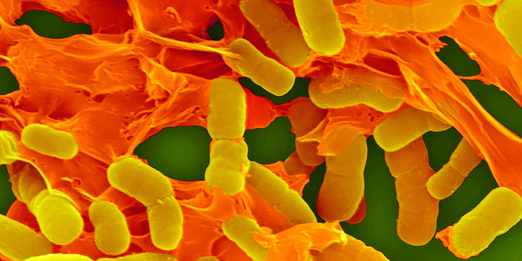 0328830b, acinetobacter, acinetobacter, baumannii, bacilli, bacillus ...